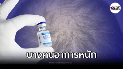 กรมการแพทย์ ชี้แจงประเด็น "ภาวะผมร่วงเป็นหย่อม" หลังการฉีดวัคซีนโควิด-19