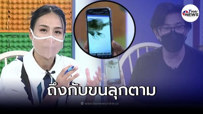 "หนุ่ม กรรชัย" เผยสาเหตุอาการคันตา หมอส่องกล้องดูเจอตัวไรเพียบ