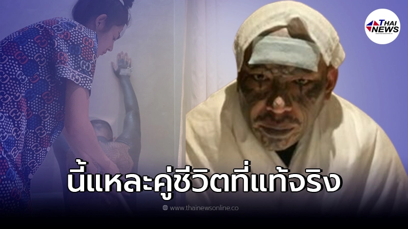 "เก่ง ลายพราง" เผยภาพ "น้องจอย" ช่วยอาบน้ำ ดูแลยามเจ็บป่วย