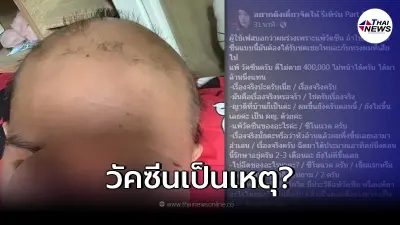 หนุ่มนักกีฬา เผยรูปหลังฉีดวัคซีนครบ 2 เข็ม แล้วแพ้หนัก หนุ่มนักกีฬา เผยรูปหลังฉีดวัคซีนครบ 2 เข็ม แล้วแพ้หนัก