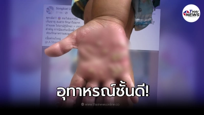 พ่อแม่ปวดใจปล่อยลูกเล่นไม่ล้างมือ กลายเป็นอุทาหรณ์ชั้นดี
