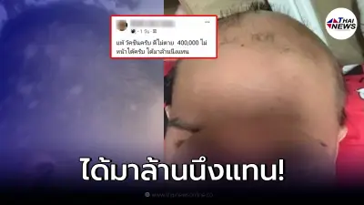 หนุ่มโพสต์ประชดแรง ลั่น! "แพ้วัคซีนครับ ดีไม่ตาย 4 แสนไม่น่าได้"