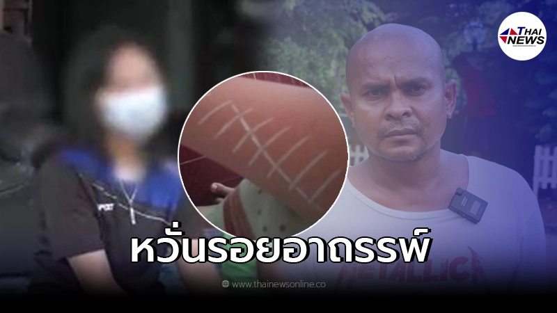 เด็กหญิงฝันเห็นผี ตื่นมาเจอรอยประหลาดที่แขน รีบขอหมอปลาช่วย