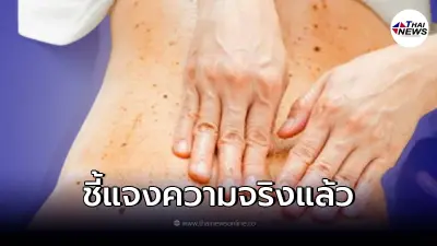 สถาบันมะเร็งฯ ชี้แจง หลังว่อนข่าว การขัดผิวแบบแห้ง ช่วยรักษามะเร็งได้ สถาบันมะเร็งฯ ชี้แจง หลังว่อนข่าว การขัดผิวแบบแห้ง ช่วยรักษามะเร็งได้
