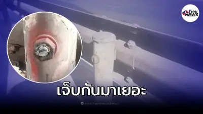 หนุ่มถูกน็อตที่กั้นฟุตบาททำบาดเจ็บ วอนหน่วยงานดูแลหวั่นเกิดเหตุร้ายแรง