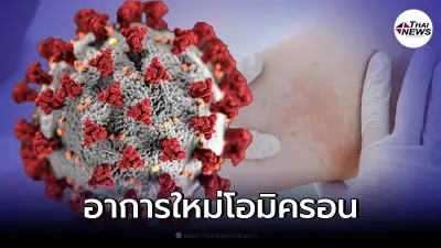 อัพเดทอาการใหม่ สัญญาณติดเชื้อ "โอมิครอน" เป็นผื่นผิวหนัง 3 ชนิด