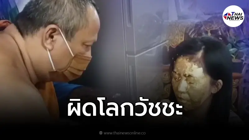 "ผิดโลกวัชชะ" พระผู้ใหญ่สั่งเบรค "นะหน้าทองเต็มหน้า" ไม่ใช่กิจของสงฆ์ "ผิดโลกวัชชะ" พระผู้ใหญ่สั่งเบรค "นะหน้าทองเต็มหน้า" ไม่ใช่กิจของสงฆ์