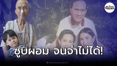 ภาพล่าสุด อาต้อย เศรษฐา หลังให้อาหารทางสายยาง ซูบผอม จนชาวเน็ตเป็นห่วง ภาพล่าสุด อาต้อย เศรษฐา หลังให้อาหารทางสายยาง ซูบผอม จนชาวเน็ตเป็นห่วง