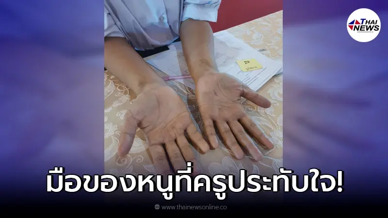 ครูพยาบาล เผยความประทับใจ หลังเห็นมือของนักเรียน ที่สอบสัมภาษณ์ ครูพยาบาล เผยความประทับใจ หลังเห็นมือของนักเรียน ที่สอบสัมภาษณ์