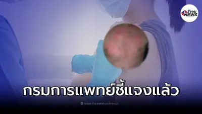 "กรมการแพทย์" เผยถึง โรคตุ่มน้ำพองใส ที่อาจเกิดขึ้นได้หลังฉีดวัคซีนโควิด