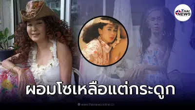 เปิดภาพล่าสุด "ติ๋ม เพ็ญพร" อดีตนางแบบดัง ผอมจนกระดูกโผล่
