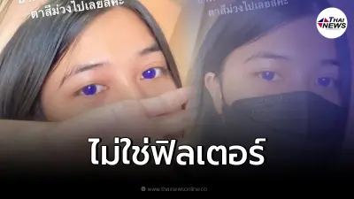 สาวกินยาฟาวิพิราเวียร์ รักษาโควิด "ตากลายเป็นสีม่วง" ยืนยันแล้วของจริง