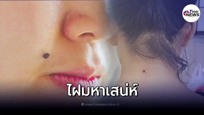 ไฝบนหน้า บอกอะไรคุณได้บ้าง ไฝตำแหน่งไหนดีเป็นไฝมหาเสน่ห์ ไฝบนหน้า บอกอะไรคุณได้บ้าง ไฝตำแหน่งไหนดีเป็นไฝมหาเสน่ห์