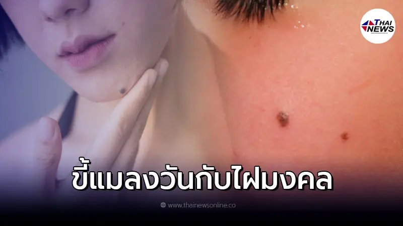 เปิดตำราโบราณ 20 ตำแหน่งไฝมงคล ใครมีถือว่าโชคดีมาก เปิดตำราโบราณ 20 ตำแหน่งไฝมงคล ใครมีถือว่าโชคดีมาก
