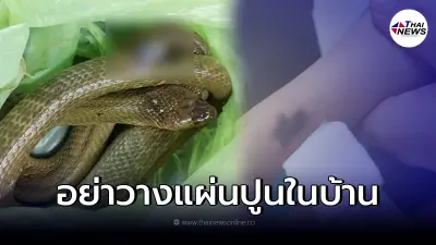 พ่อเตือนเป็นบทเรียน "ลูกโดนงูเห่ากัด" ลุ้นทุกนาที