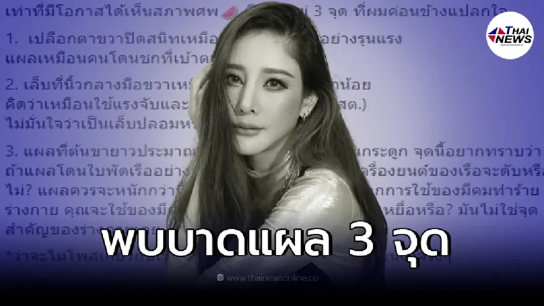 เรื่องนี้มีเงื่อนงำ ร่าง  "แตงโม นิดา"  พบบาดแผล 3 จุดไม่ชอบมาพากล