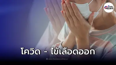ไขข้อข้องใจ "โควิด-ไข้เลือดออก" อาการต่างกันอย่างไร มีคำตอบ