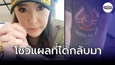 "ต่าย สายธาร" โชว์แผลจากการค้นหาร่าง "แตงโม นิดา" พร้อมข้อคิดทิ้งท้าย