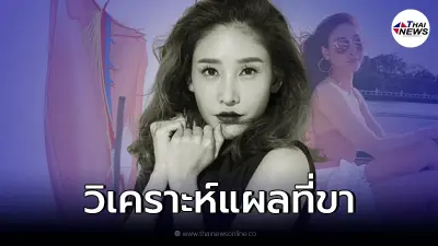 แพทย์ชื่อดัง วิเคราะห์บาดแผลที่ขา "แตงโม นิดา" พร้อมสรุปชัดเกิดขึ้นตอนไหน