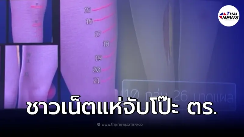 ชาวเน็ตแห่เปิดภาพเทียบ "แผลแตงโม" จับโป๊ะตำรวจแถลงสรุปสำนวนคดี ชาวเน็ตแห่เปิดภาพเทียบ "แผลแตงโม" จับโป๊ะตำรวจแถลงสรุปสำนวนคดี