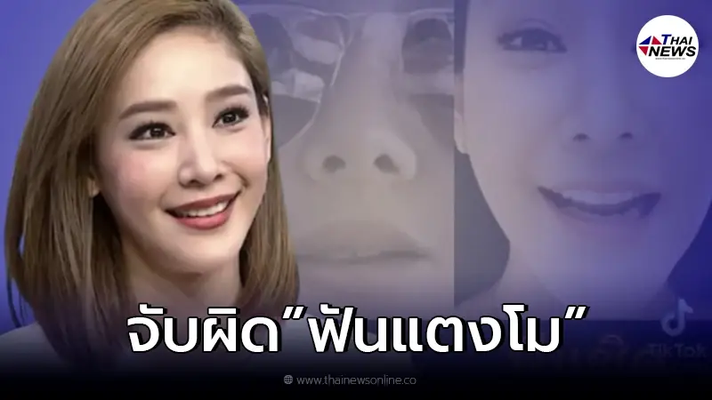 ชาวเน็ตตาดีจับพิรุธใหม่ฟัน "แตงโม" หลุดโฟกัส ตรงกับคำพูดเพื่อนสนิท