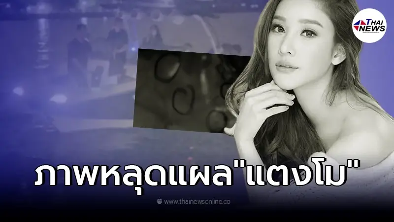 แห่สงสัยภาพหลุด "แผลรูลึกปริศนา 5 รู" บริเวณหน้าอก "แตงโม นิดา" แห่สงสัยภาพหลุด "แผลรูลึกปริศนา 5 รู" บริเวณหน้าอก "แตงโม นิดา"