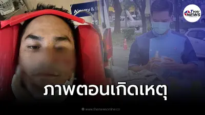 "สงกรานต์" เผยภาพนาทีเกิดเหตุต้องนอนไอซียู 7 วัน อาการหนักปอดทะลุ-เจาะคอ "สงกรานต์" เผยภาพนาทีเกิดเหตุต้องนอนไอซียู 7 วัน อาการหนักปอดทะลุ-เจาะคอ