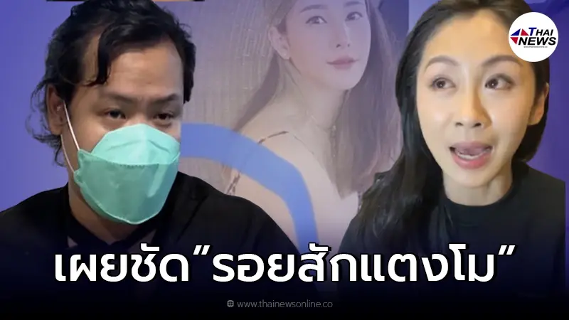 "ฮิปโป" เผยความจริงเรื่อง "รอยสักแตงโม" หลังมีภาพหลุด