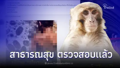 สธ. ชี้แจง หลังมีข่าวจนท.อุทยานเกาะช้าง-เกาะล้าน เป็นโรคฝีดาษลิง จำนวน 9 คน