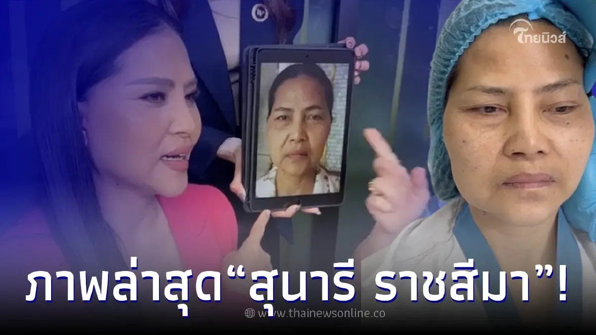 ส่องใบหน้าล่าสุด "สุนารี" หลังทำศัลยกรรมครบ 1 เดือน สวยขึ้น หน้าเด็กมาก ส่องใบหน้าล่าสุด "สุนารี" หลังทำศัลยกรรมครบ 1 เดือน สวยขึ้น หน้าเด็กมาก