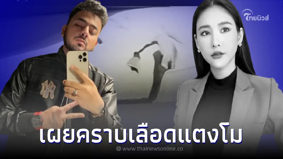 "บังแจ็ค" สวนกลับ เปิดรูปอ้างเป็นคราบเลือดแตงโม "บังแจ็ค" สวนกลับ เปิดรูปอ้างเป็นคราบเลือดแตงโม