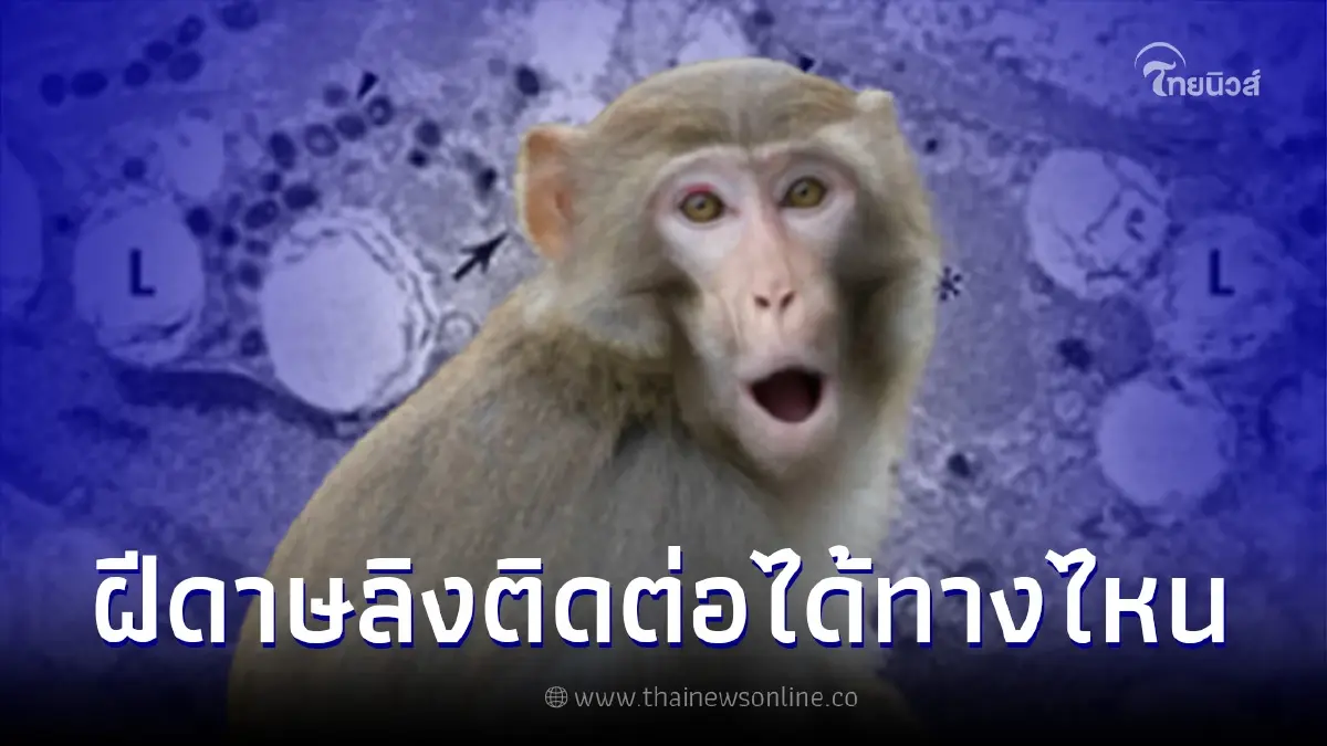 ทำความรู้จัก "โรคฝีดาษลิง" ติดต่อในมนุษย์ได้อย่างไร ต้องแยกรักษาตัวกี่วัน