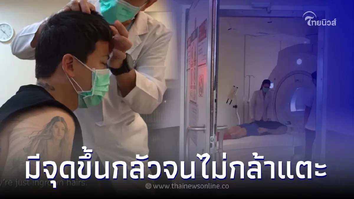 ป๊อก ภัสสรกรณ์ เผยอาการหลังผ่าตัดสมอง รู้สึกแปลก มีจุดขึ้นที่หัว