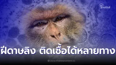 โรคฝีดาษลิง ติดเชื้อได้ทางไหนบ้าง ทำความเข้าใจโรคลดความเสี่ยง