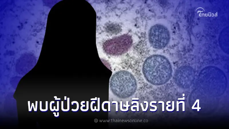 ไทยพบผู้ป่วยโรคฝีดาษลิง รายที่ 4 เพศหญิง ใน กทม.