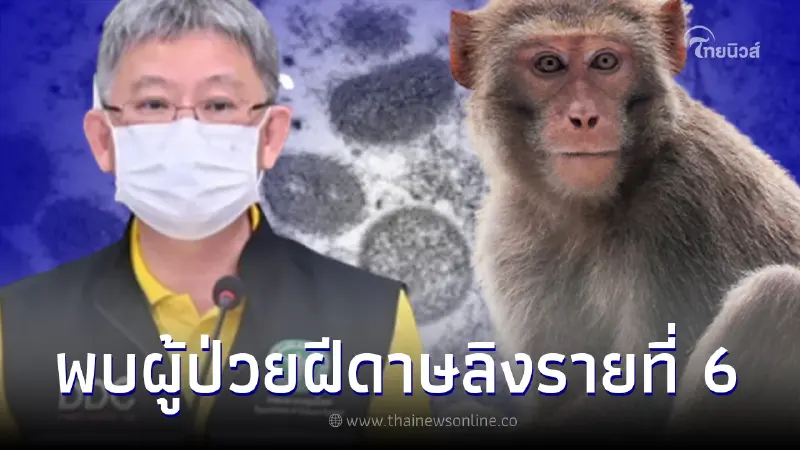 สธ.ยืนยัน ไทยพบผู้ป่วยฝีดาษลิงรายที่ 6 เป็นหญิงไทย เดินทางกลับจากกาตาร์ สธ.ยืนยัน ไทยพบผู้ป่วยฝีดาษลิงรายที่ 6 เป็นหญิงไทย เดินทางกลับจากกาตาร์