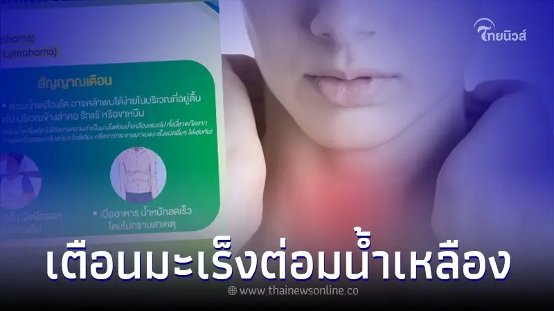 เปิดสัญญาณแรก“มะเร็งต่อมน้ำเหลือง”ใครมี หาหมอด่วน ก่อนลุกลาม เกินแก้ไข เปิดสัญญาณแรก“มะเร็งต่อมน้ำเหลือง”ใครมี หาหมอด่วน ก่อนลุกลาม เกินแก้ไข