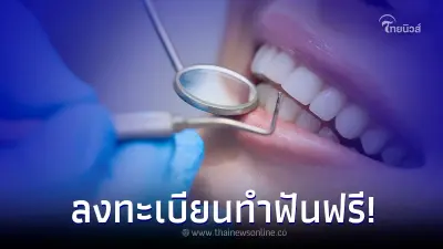 กรมการแพทย์ เปิดให้บริการทำฟันฟรี 200 ราย เช็ควิธีลงทะเบียนเลย