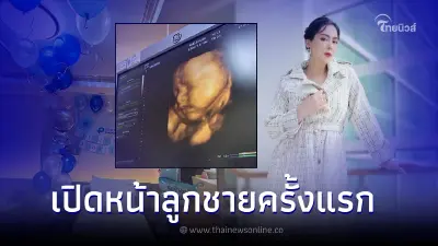 "บุ๋ม ปนัดดา" เปิดภาพอัลตราซาวด์ลูกชายครั้งแรก ส่องชัดๆหน้าเหมือนใคร
