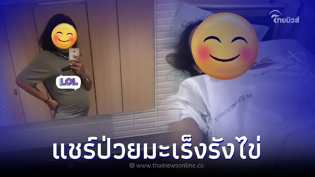 สาววัย 19 ปี แชร์ประสบการณ์ป่วยมะเร็งรังไข่ ระยะที่ 2