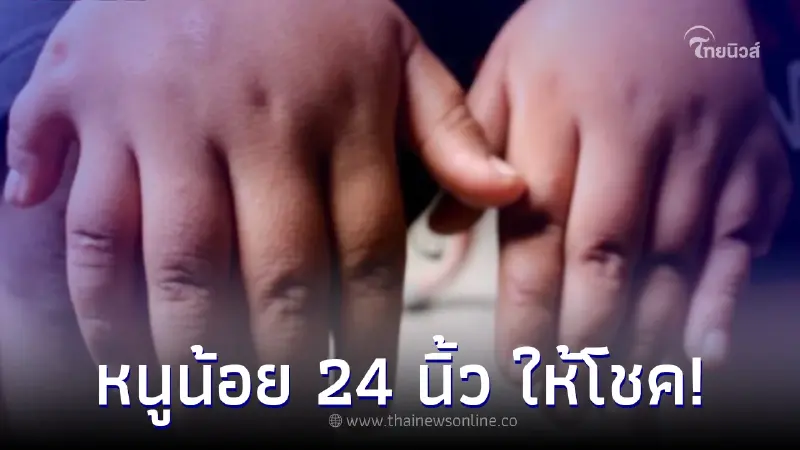 หนูน้อย 6 ขวบ มีนิ้วมือ+นิ้วเท้า รวมกัน 24 นิ้ว แม่เผยลูกให้โชคมาตั้งแต่เด็ก หนูน้อย 6 ขวบ มีนิ้วมือ+นิ้วเท้า รวมกัน 24 นิ้ว แม่เผยลูกให้โชคมาตั้งแต่เด็ก