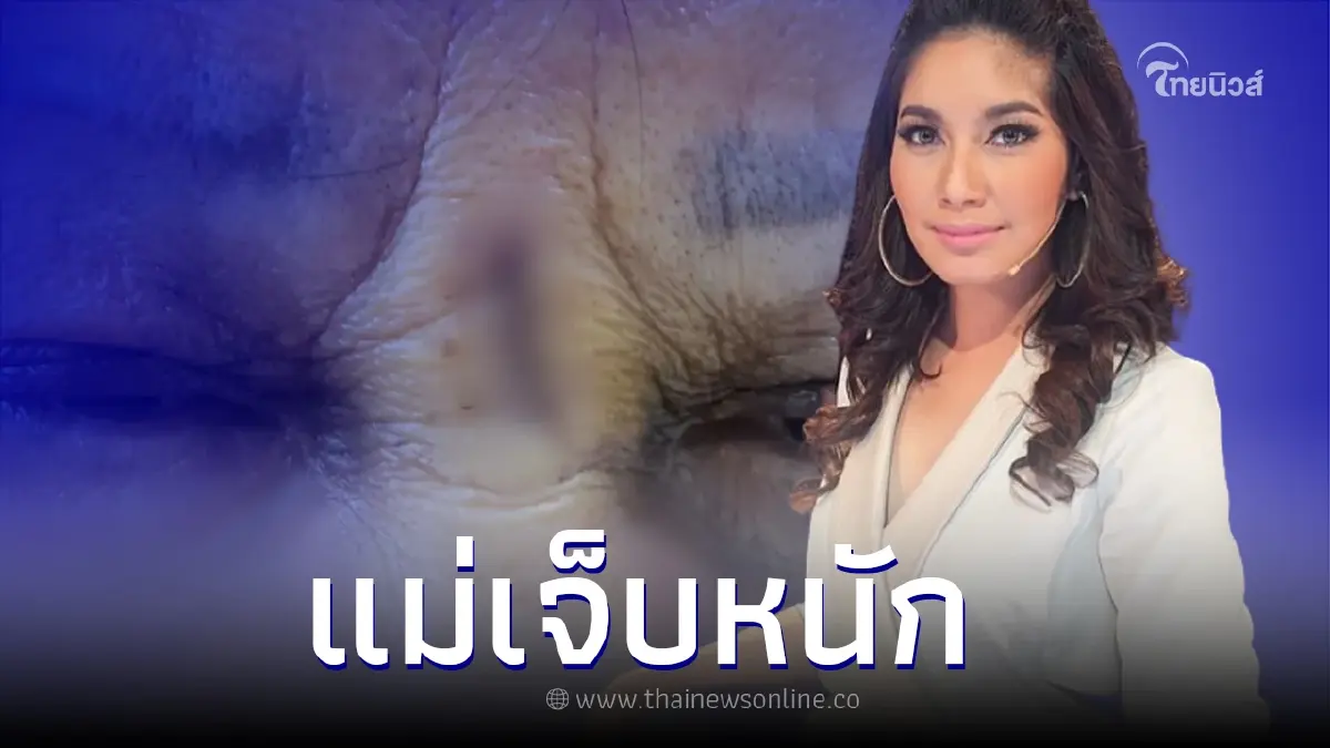 คุณแม่ "เบนซ์ พรชิตา" เกิดอุบัติเหตุในห้าง บาดเจ็บไร้การเยียวยา