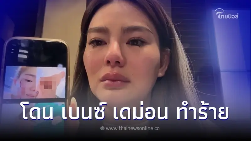 ดิว อริสรา ปล่อยโฮเผยภาพหลักฐาน ที่โดน เบนซ์ เดม่อน ทำร้ายร่างกายอย่างหนัก