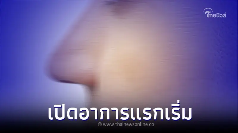 รู้จัก มะเร็งหลังโพรงจมูก อาการแรกเริ่มคล้ายโรคทั่วไป อย่าชะล่าใจเด็ดขาด รู้จัก มะเร็งหลังโพรงจมูก อาการแรกเริ่มคล้ายโรคทั่วไป อย่าชะล่าใจเด็ดขาด
