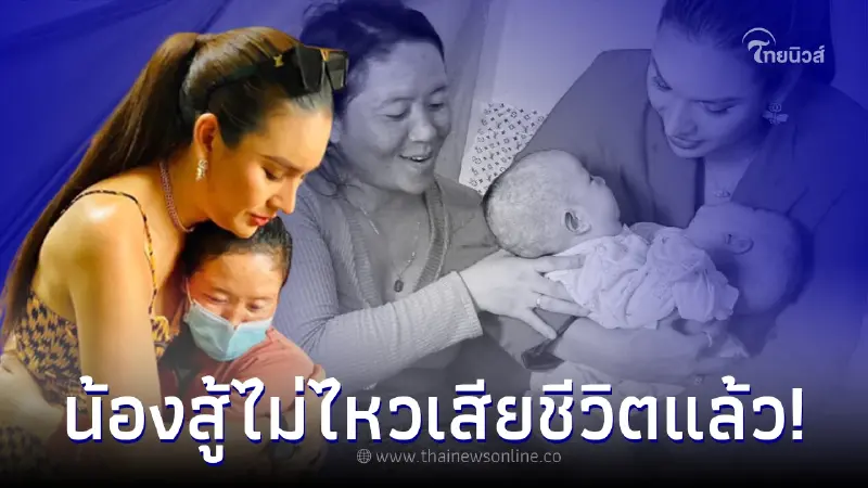 เศร้า ฝาแฝดผ่าตัดแยกร่าง สู้ต่อไม่ไหว เสียชีวิตแล้ว แพทย์เผยอาการก่อนจากไป เศร้า ฝาแฝดผ่าตัดแยกร่าง สู้ต่อไม่ไหว เสียชีวิตแล้ว แพทย์เผยอาการก่อนจากไป