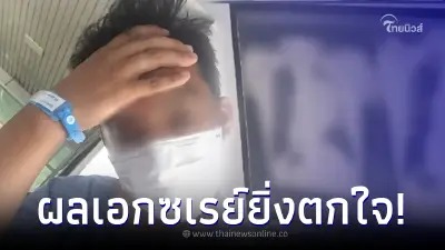 หนุ่มวัย 24 ป่วยมะเร็งปอด ทั้งที่ไม่ดื่มเหล้า-สูบบุหรี่ ผลเอกซเรย์ยิ่งตกใจ