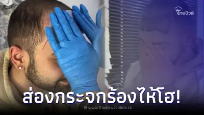 หนุ่มเครียด หน้าผากกว้างเกิน ไปให้ช่างสักช่วยแก้ปัญหา เห็นผลงานร้องไห้โฮ