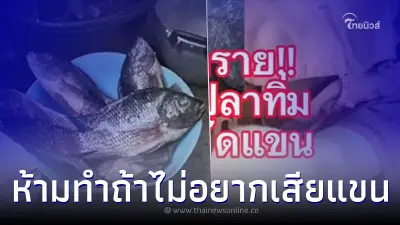 หมอจำใจตัดแขนรักษาชีวิตคนไข้เงี่ยงปลาทิ่มมือ เผยสาเหตุหลายคนคาดไม่ถึง
