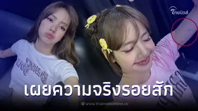 "ลิซ่า BLACKPINK" เผยความจริงเรื่องรอยสัก หลังโดนแฟนๆ เข้าใจผิดไปทั่วโลก "ลิซ่า BLACKPINK" เผยความจริงเรื่องรอยสัก หลังโดนแฟนๆ เข้าใจผิดไปทั่วโลก