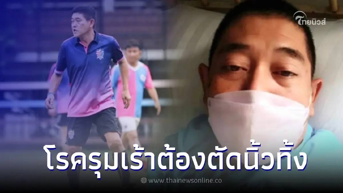 "สาธิต จึงสำราญ" อดีตทีมชาติไทย ป่วยหนักถึงขั้นต้องตัดนิ้วเท้าทิ้ง "สาธิต จึงสำราญ" อดีตทีมชาติไทย ป่วยหนักถึงขั้นต้องตัดนิ้วเท้าทิ้ง